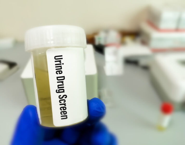 A gloved hand holding a labeled specimen container for a urine drug screen test, checking if HHC shows up, in a clinical setting.
